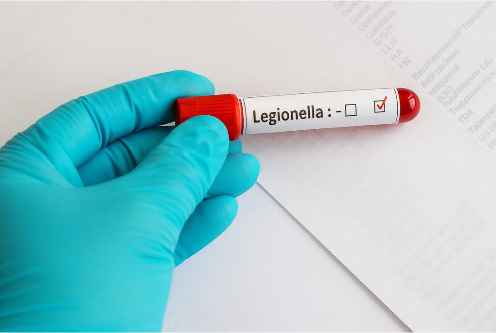 Analisi Legionella 360